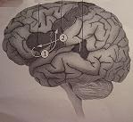 Ο αριστερός εγκέφαλος και το τραύλισμα