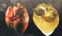 Καρδιαγγειακά νοσήματα και λειτουργία μυών